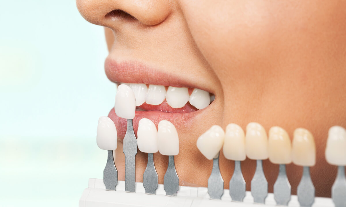 口元を美しく、自信の持てる笑顔に