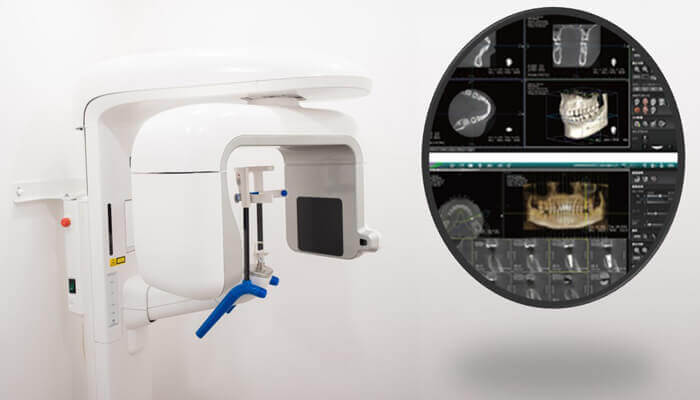 歯科用CTによる診断「最新設備を完備」